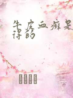 牛皮血癣是怎么得的