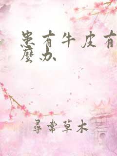 患有牛皮有癣怎么办