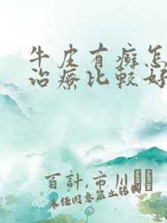 牛皮有癣怎么样治疗比较好