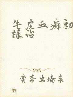 牛皮血癣初期怎样治