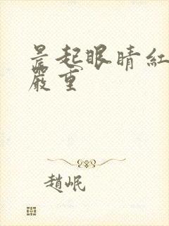 晨起眼睛红血丝严重