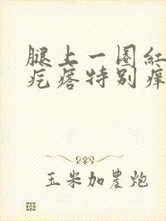 腿上一圈红色的疙瘩特别痒