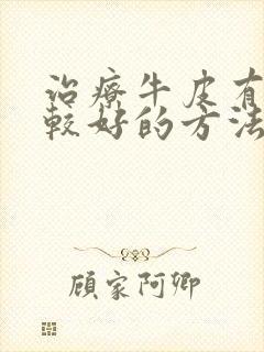 治疗牛皮有癣比较好的方法