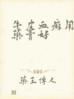 牛皮血癣用什么药膏好