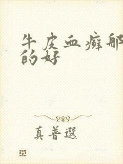 牛皮血癣那里治的好