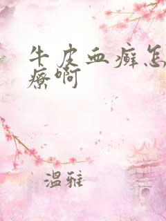 牛皮血癣怎么治疗啊