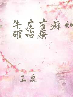 牛皮有癣如何正确治疗