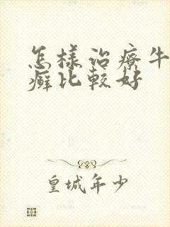 怎样治疗牛皮有癣比较好