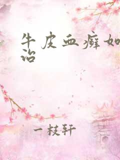 牛皮血癣如何医治