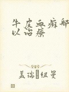 牛皮血癣哪里可以治疗