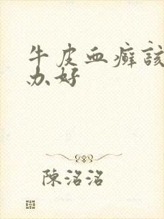 牛皮血癣该怎么办好