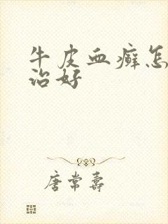 牛皮血癣怎么能治好