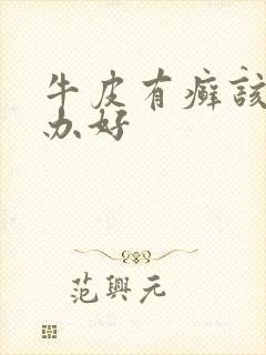 牛皮有癣该怎么办好