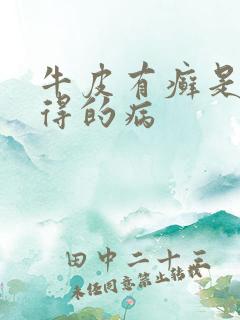 牛皮有癣是怎么得的病