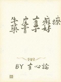 牛皮有癣擦什么药膏子好