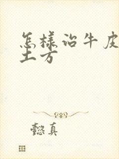 怎样治牛皮血癣土方