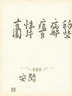 有性疾病的症状图片有哪些