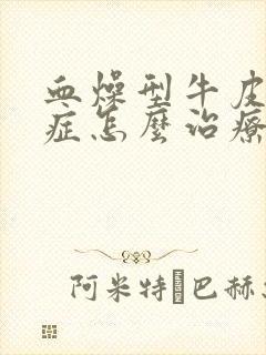 血燥型牛皮血癣症怎么治疗