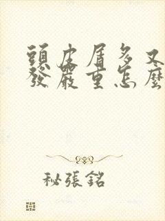 头皮屑多又痒掉发严重怎么治疗