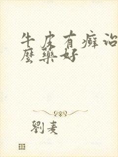 牛皮有癣治疗什么药好