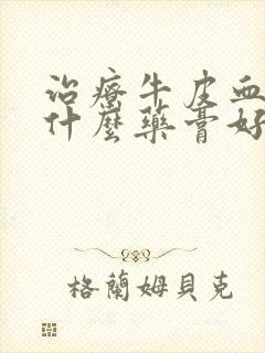 治疗牛皮血癣用什么药膏好