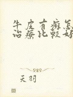 牛皮有癣怎么样治疗比较好