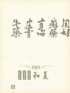 牛皮有癣用什么药膏治疗好的快些