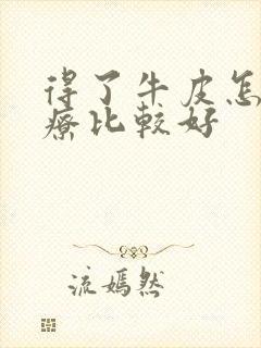 得了牛皮怎么治疗比较好