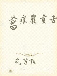 齿痕严重舌苔发白