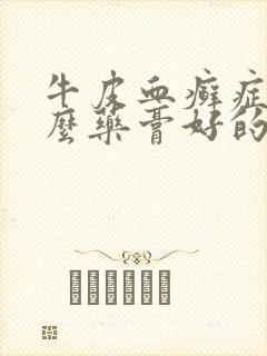 牛皮血癣症用什么药膏好的快