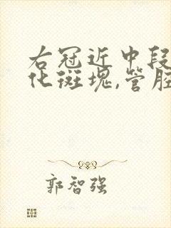 右冠近中段非钙化斑块,管腔轻度狭窄