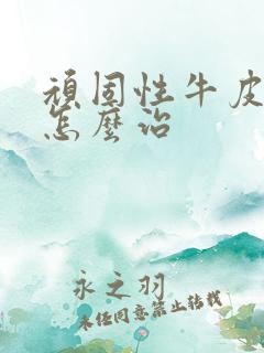 顽固性牛皮血癣怎么治