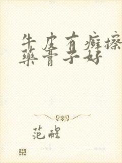 牛皮有癣擦什么药膏子好