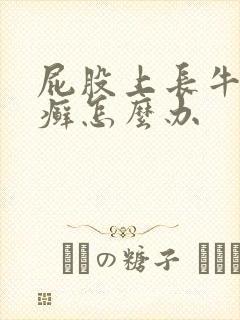 屁股上长牛皮有癣怎么办