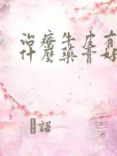 治疗牛皮有癣用什么药膏好的快