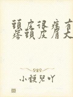 头皮很痒有红疙瘩头皮屑大块