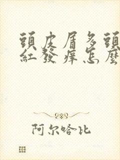 头皮屑多头皮发红发痒怎么治