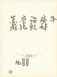 怎么治疗牛皮有癣比较好