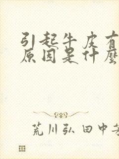 引起牛皮有癣的原因是什么