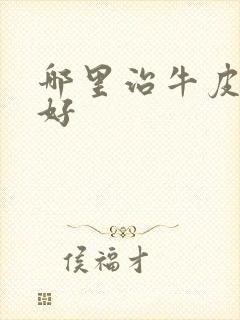 哪里治牛皮血癣好