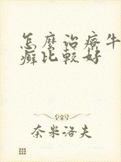 怎么治疗牛皮有癣比较好