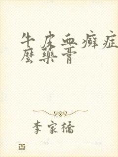 牛皮血癣症用什么药膏