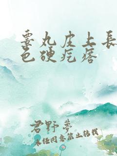 睾丸皮上长了白色硬疙瘩