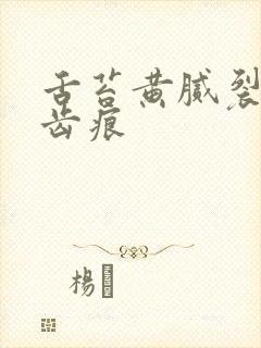 舌苔黄腻裂纹有齿痕