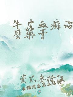 牛皮血癣治疗什么药膏