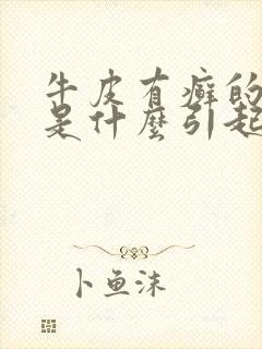 牛皮有癣的原因是什么引起的