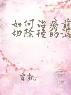 如何治疗前列腺切除后的漏尿