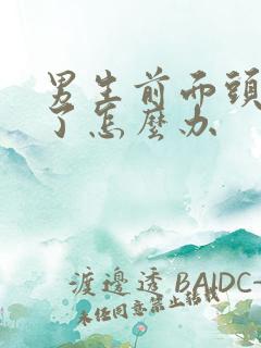 男生前面头发秃了怎么办