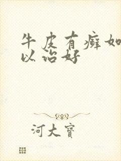 牛皮有癣如何可以治好