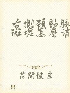 右侧颈动脉血管斑块怎么消除